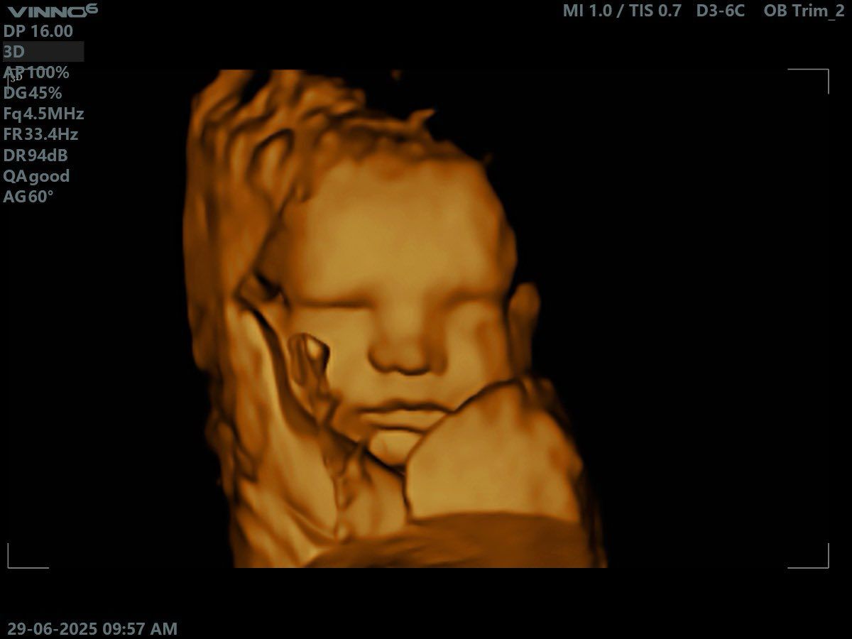 Agape Scan Studio baby scan