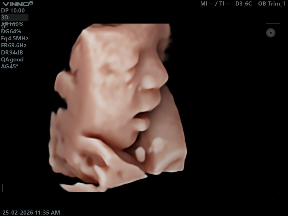 The Little Wonder Package