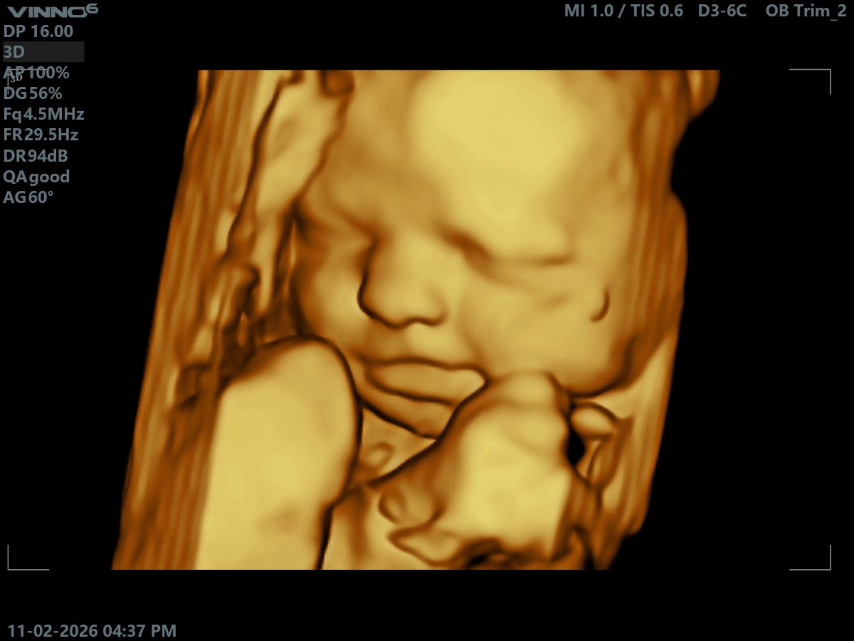 Agape Scan Studio baby scan