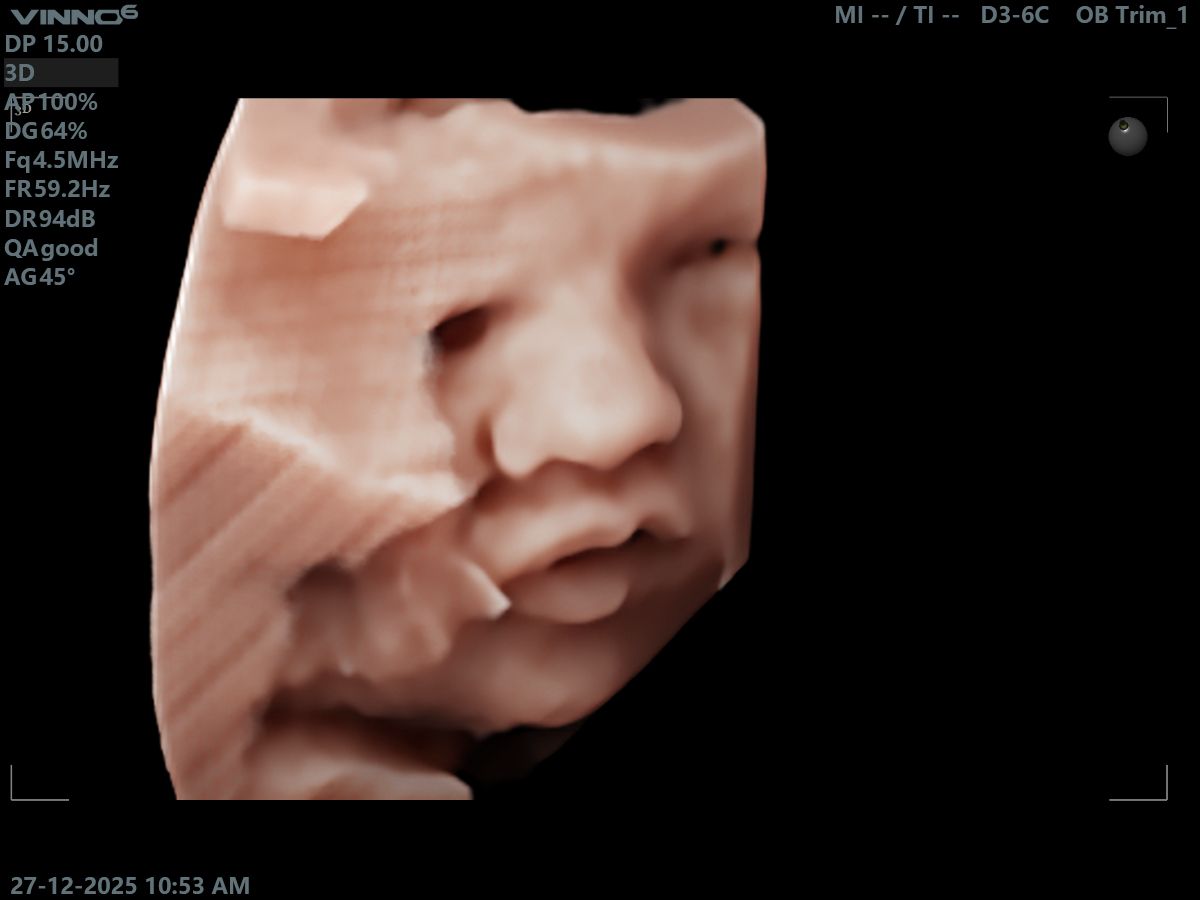 Agape Scan Studio baby scan