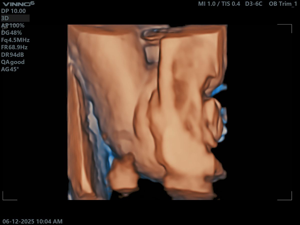 Agape Scan Studio baby scan