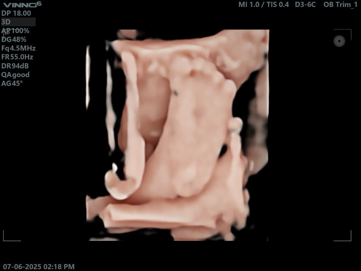 Agape Scan Studio baby scan