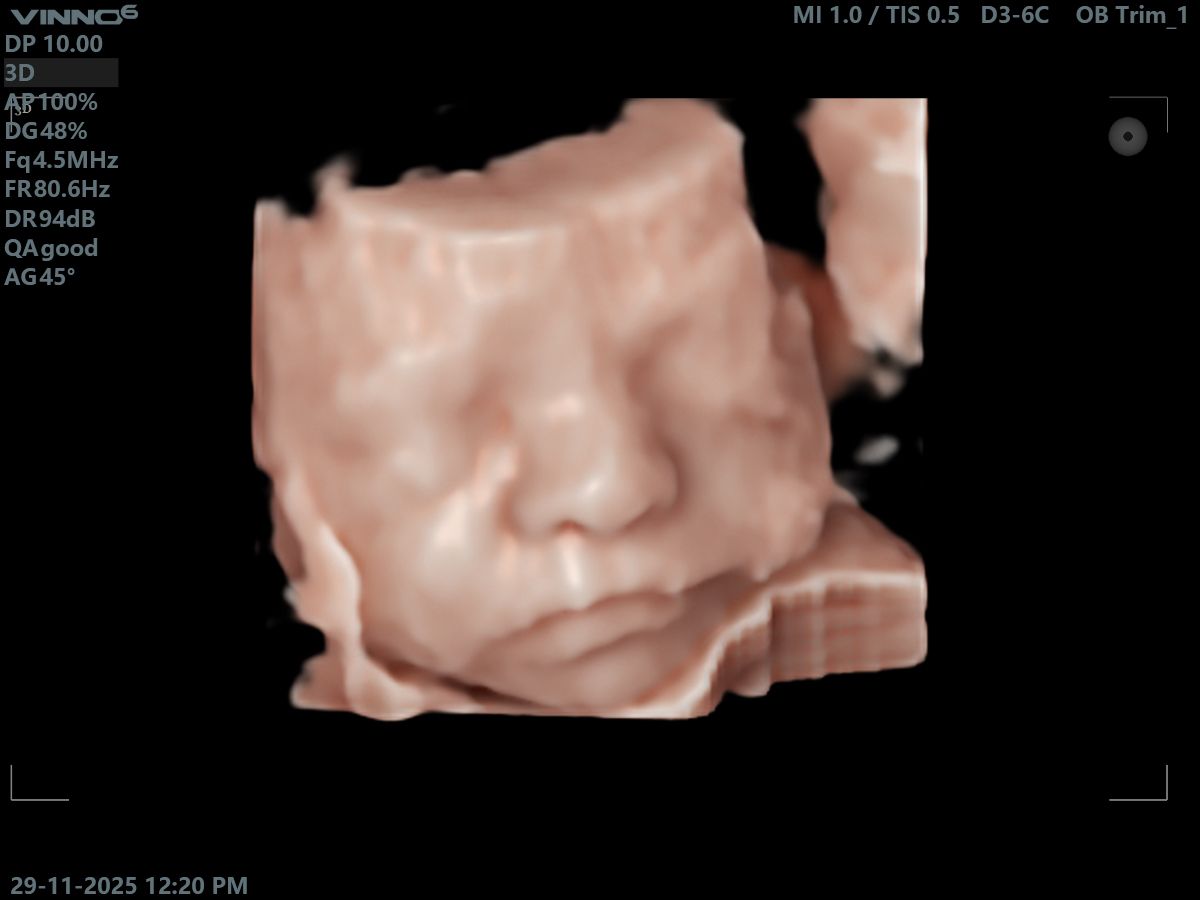 Agape Scan Studio baby scan