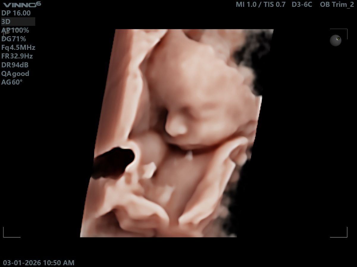 Agape Scan Studio baby scan