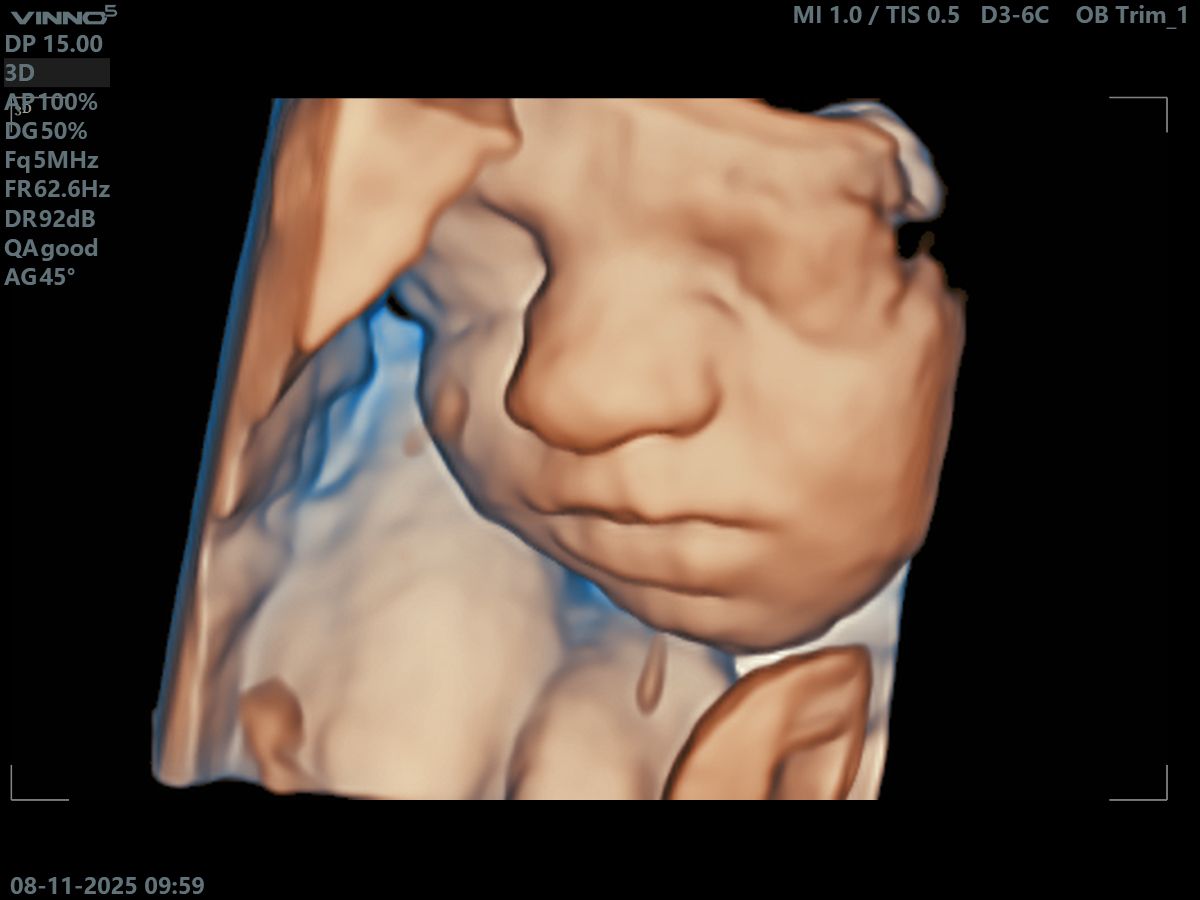 Agape Scan Studio baby scan