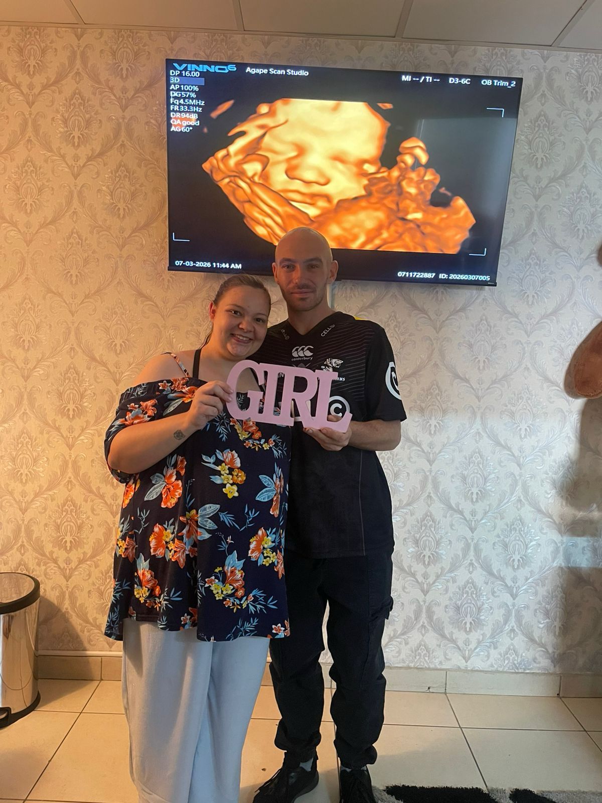 Agape Scan Studio baby scan