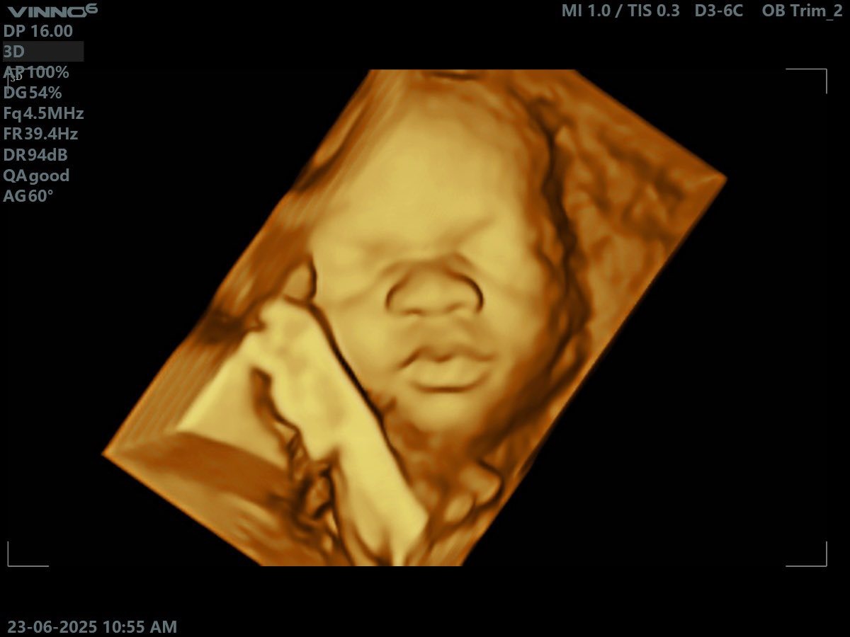 3D/4D Scan Experience