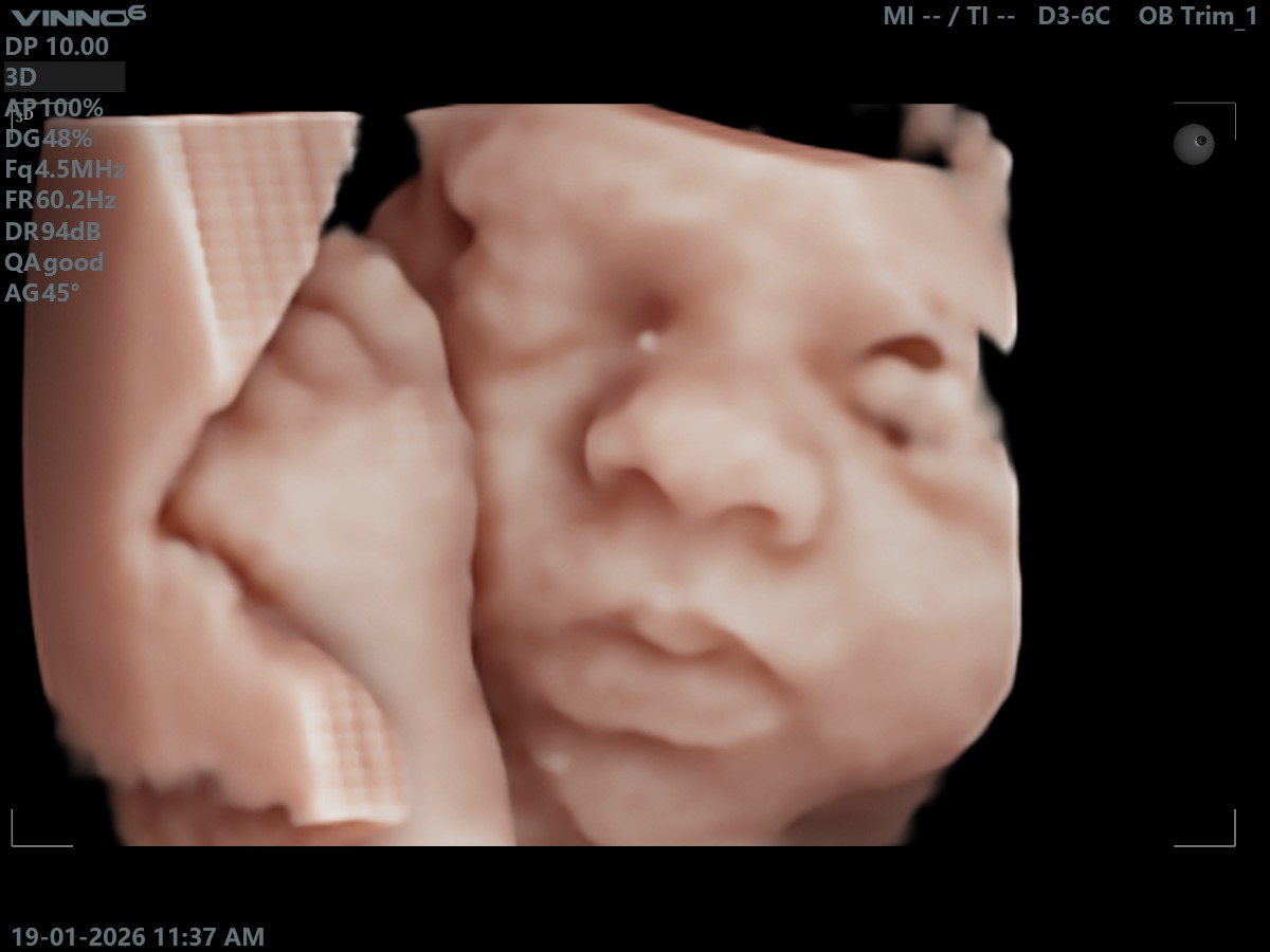 5D / HD Live Scan